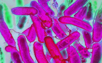 Resistant Bacteria Are Advancing Faster Than Antibiotics – Trends
