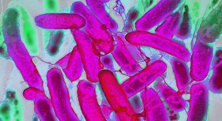 Resistant Bacteria Are Advancing Faster Than Antibiotics – Trends