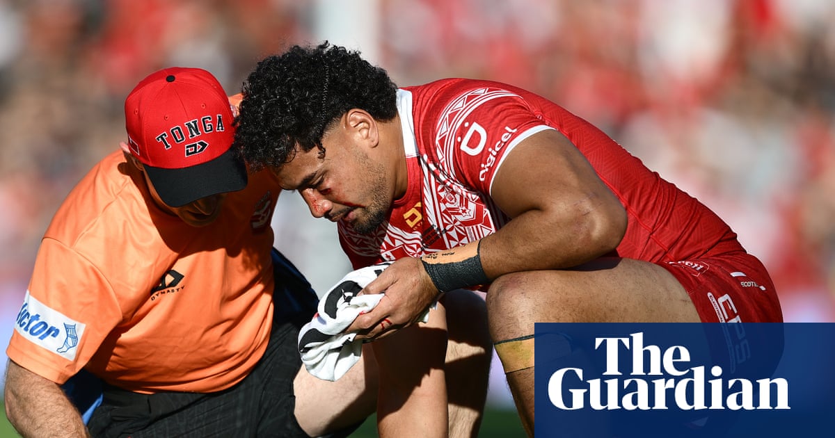atlantisthemes - Eli Katoa’s seizure and brain bleed prompts calls for NRL to assess concussion protocols
